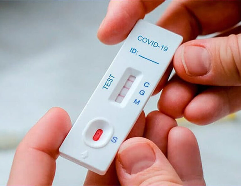 Minsa recomienda no comprar autotest COVID-19 a través de páginas web o redes sociales